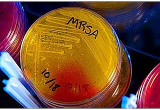 In dieser Petrischale wachsen MRSA-Keime. Foto: CDC/Melissa Dankel