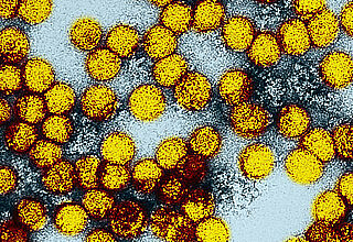Gelbfieber-Viren unter einem Elektronenmikroskop. Forscher des Max-Planck-Instituts für Dynamik komplexer technischer Systeme vermehren die Erreger in Bioreaktoren. Diese Technik könnte bald auch in der Impfstoffherstellung angewendet werden.© Alamy / CDC / BSIP