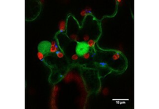 Kontakte verschiedener Organellen in einer Blattepidermiszelle von Tabak (grün, Zellkerne und Zytosol; rot, Chloroplasten; blau, Peroxisomen). Maßstab, 10 µm. (Bild von Larissa Launhardt)