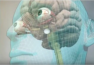 Wechselstrom-Stimulation des Gehirns verbessert Sehleistung bei Patienten mit Glaukom und Sehnervschädigung