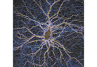 Eine Nervenzelle, gewachsen in einer Kulturschale, hat Hunderte synaptische Kontakte (weiße Punkte) zu anderen Nervenzellen aufgebaut. Um in solchen Netzwerken Informationen speichern zu können, werden Moleküle, die auf der Oberfläche der Zelle (orange) und an den Synapsen vorkommen, gebraucht. Sie helfen die Synapsenfunktion an die Aktivität im Netzwerk anzupassen. Wie sich Synapsen mit zunehmendem Alter verändern, will das Graduiertenkolleg "SynAGE" in den nächsten Jahren in verschiedenen Projekten erforschen