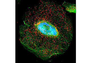 Immunfluoreszenfärbung eines menschlichen Podozyten, Bild: Sanchita Ghosh
