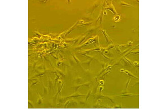 Primäre Hühnerembryofibroblasten in 40facher Vergrößerung