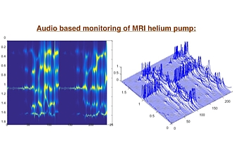 Audio Signal Evaluation of MRI Helium Pump