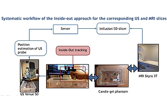 Ultrasound - MRI Fusion -- work diagram