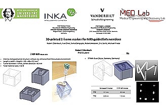 RP Marker -- joint project between Vanderbilt and OVGU