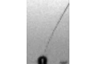 Oszillierende Blase am unteren Bildrand emittiert Mikrobläschen