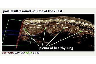 Detailbild zu :  Ultraschall der Thoraxregion - von 2D zu 3D