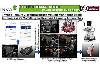 Detailbild zu :  Thyroid Texture Classification and Volume Monitoring using Autoregressive Modelling and Machine Learning Approaches