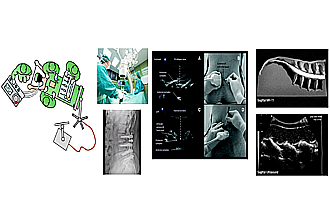 Detailbild zu :  Ultraschallbasierte Wirbelsäulennavigation
