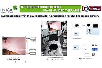 Detailbild zu :  Augmented Reality im Operationssaal: Eine Anwendung für die endoskopische HNO-Chirurgie