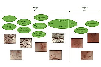 Detailbild zu :  Automatic Classification of Laryngeal Histopathologies Based on Vascular Patterns in Larynx Contact Endoscopy Images