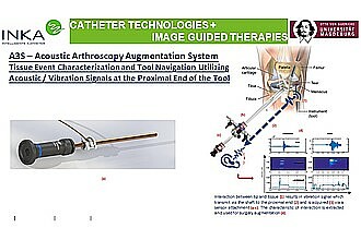 Detailbild zu :  A3S - Acoustic Arthroscopy Augmentation System

Tissue Event Characterization and Tool Navigation Utilizing Acoustic / Vibration Signals at the Proximal End of the Tool