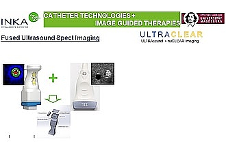 Detailbild zu :  Entwicklung eines neuartigen Gamma-Ultraschall-Scanners für den Einsatz in der radiogesteuerten Chirurgie