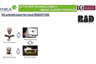 Detailbild zu :  Integration der Radionuklidtherapie mit der 3D-Drucktechnologie