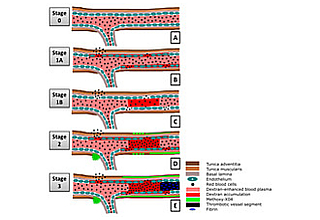 Detailbild zu :  Gemischte zerebrale Pathologien und kognitives Altern
