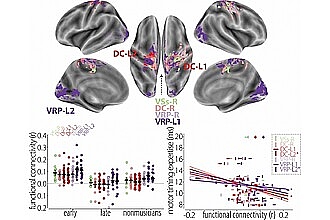 Detailbild zu :  Perioperative Anpassungen funktioneller Gehirnnetzwerke