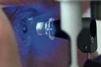Augenärztliche Untersuchungen sind das Bindeglied zwischen Patientenversorgung und Sehforschung.