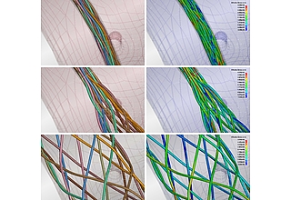 Flow Diverter, Katheter und Gefäß während drei verschiedenen Stufen des Platzierungsvorgangs