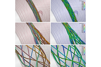 Flow Diverter, Katheter und Gefäß während drei verschiedenen Stufen des Platzierungsvorgangs