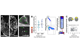 A. Ultra-high-resolution MRI of the small arteries (ToF MRA) and veins (QSM) (left) and of enlarged white matter/transcortical perivascular spaces (T2) as well as small vessel wall leakage in terms of BBB breakage (contrast enhanced T1) (right). B. Blood-based biomarker measures of ECM (cleaved (cl.) brevican, ELISA, left) and NVU markers or cytokines (FACS, right) in controls (Ctrl) and hypertension (HYP). C. Frontal network activity applying resting state functional MRI and its relationship to executive function in ageing. Abbreviations: BBB, blood-brain barrier; cl, cleaved; Ctrl, controls; ECM, extracellular matrix; ELISA, enzyme-linked immunosorbent assay; FACS, fluorescence activated cell sorting; HYP, hypertension; MRA, magnetic resonance angiography; MRI, magnetic resonance imaging; NVU, neurovascular unit; QSM, quantitative susceptibility mapping; ToF, time of flight.