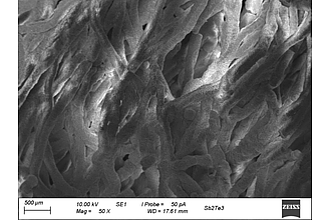 Aluminium-Wolle nach dem Nitridieren