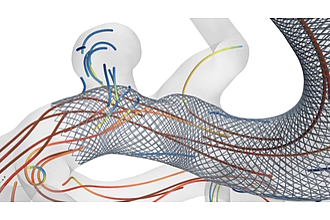 Computergestützte Simulation eines Flow-Diverter-Stents im Trägergefäß eines intrakraniellen Aneurysmas. Repräsentation des Blutflusses auf Basis von geschwindigkeitscodierten Stromlinien.