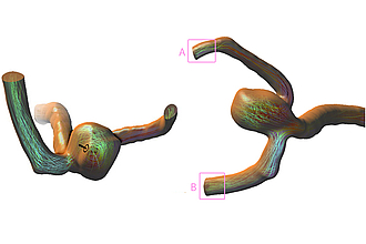 Detailbild zu :  Illustrative und wahrnehmungsbasierte medizinische Visualisierung