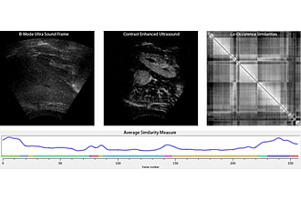 The co-occurrence similarities and the average similarity of ultrasound frames are used to identify consecutive time frames depicting the same scene.