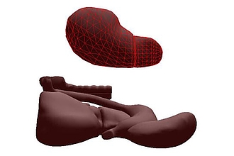 FE-Modell einer Leber (oben) und Simulationsmodell: Leber, Darm, Galle, ... (unten)