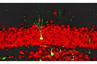 Neugebildetes Neuron im Hippocampus der Ratte