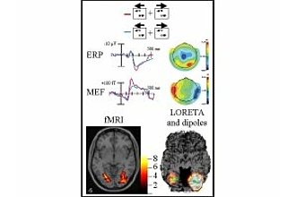 Detailbild zu :  Räumlich-zeitlich neurophysiologische Korrelate der objektbezogenen Aufmerksamkeit.