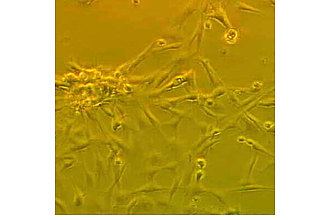 Primary CEF in static culture (40x magn.)