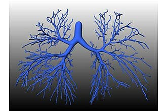 Ausgusspräparat der Bronchialgefäße einer menschlichen Lunge